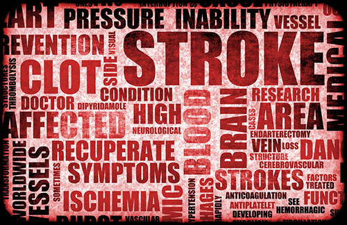 stroke and stroke causes
