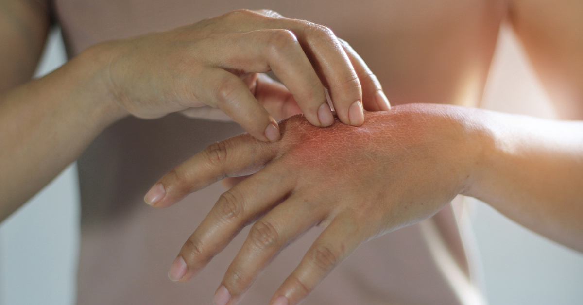 a close up of a hand