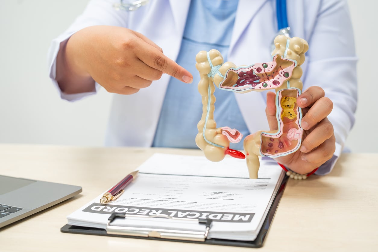 A doctor points to a plastic model of the human digestive tract while discussing gut health issues.