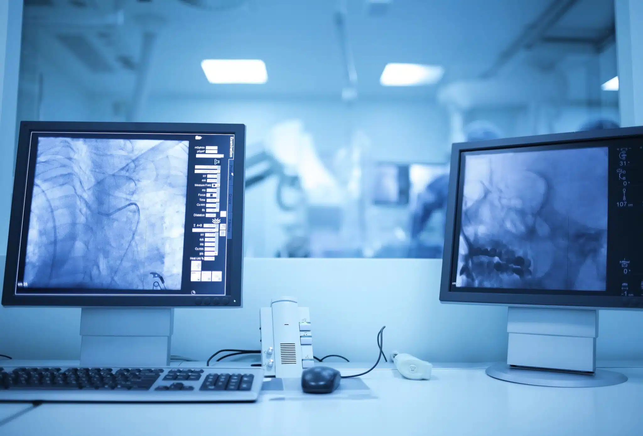 Two computer monitors and an operating room inside a Cath Lab at UAB Medical West