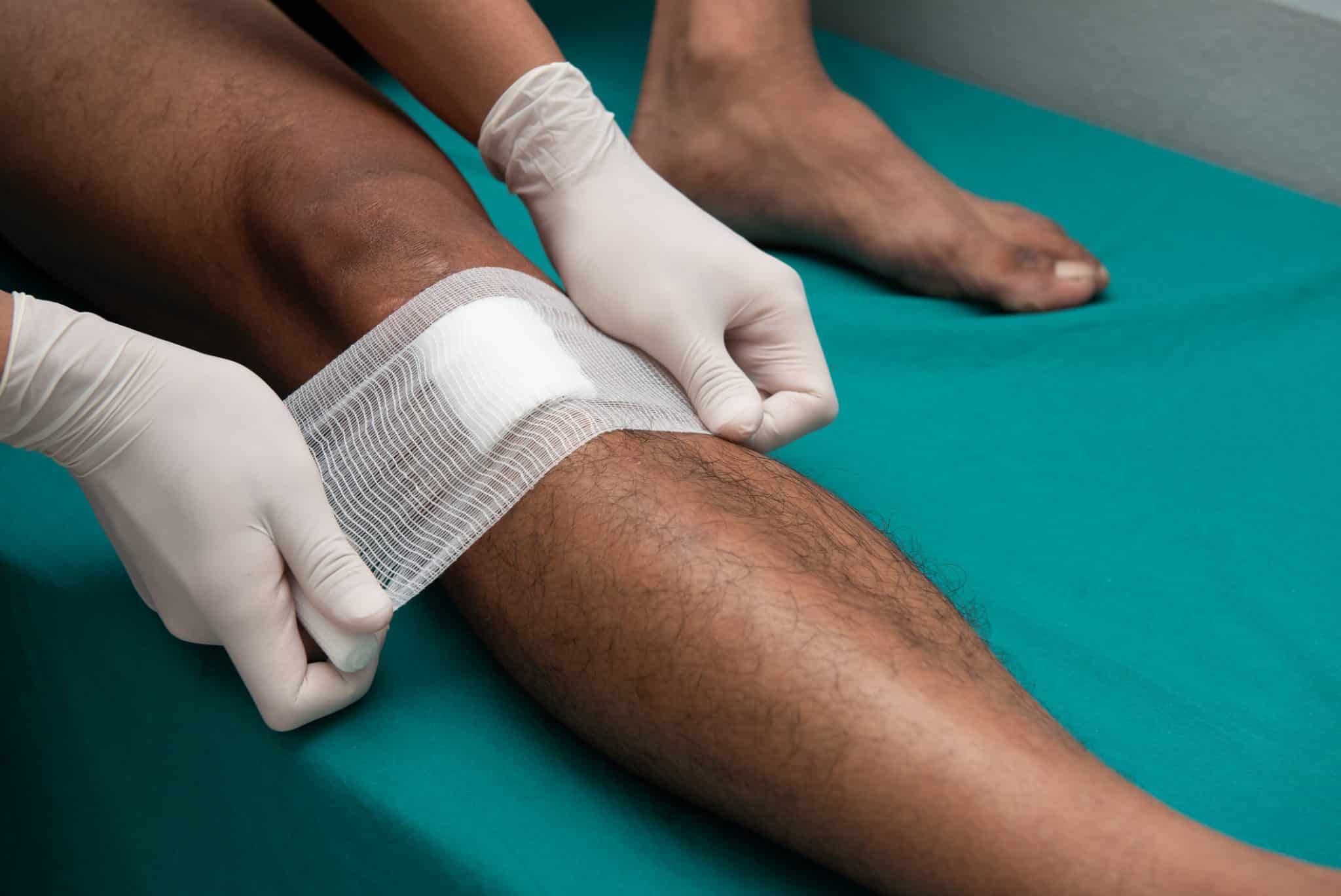A doctor at UAB Medical West's Wound Care Clinic providing treatment for a slow healing leg wound.