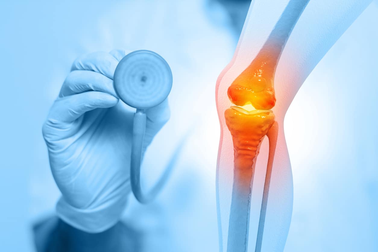 A 3D illustration of an orthopedic doctor examining a knee joint for knee and joint pain.